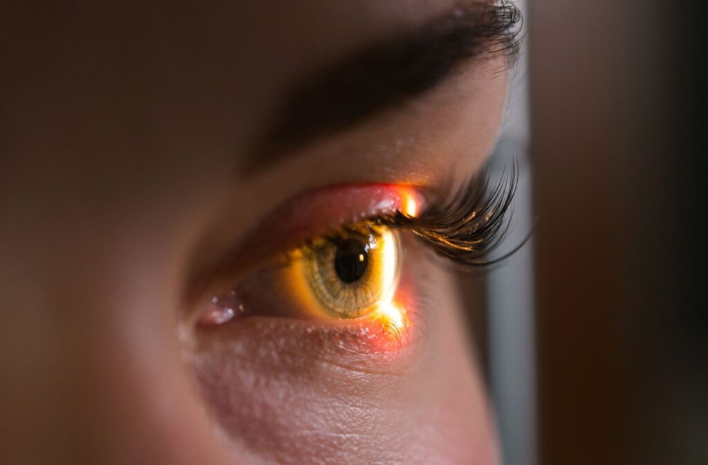 A close up of someones eye getting examined during an eye test